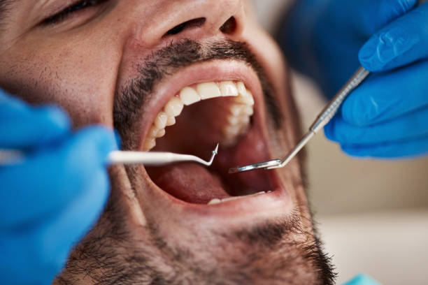 Best Urgent Care for Lost Fillings or Crowns in Gloucester Point, VA